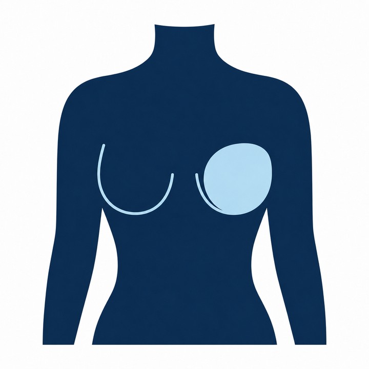 乳腺エコーのボディマーク